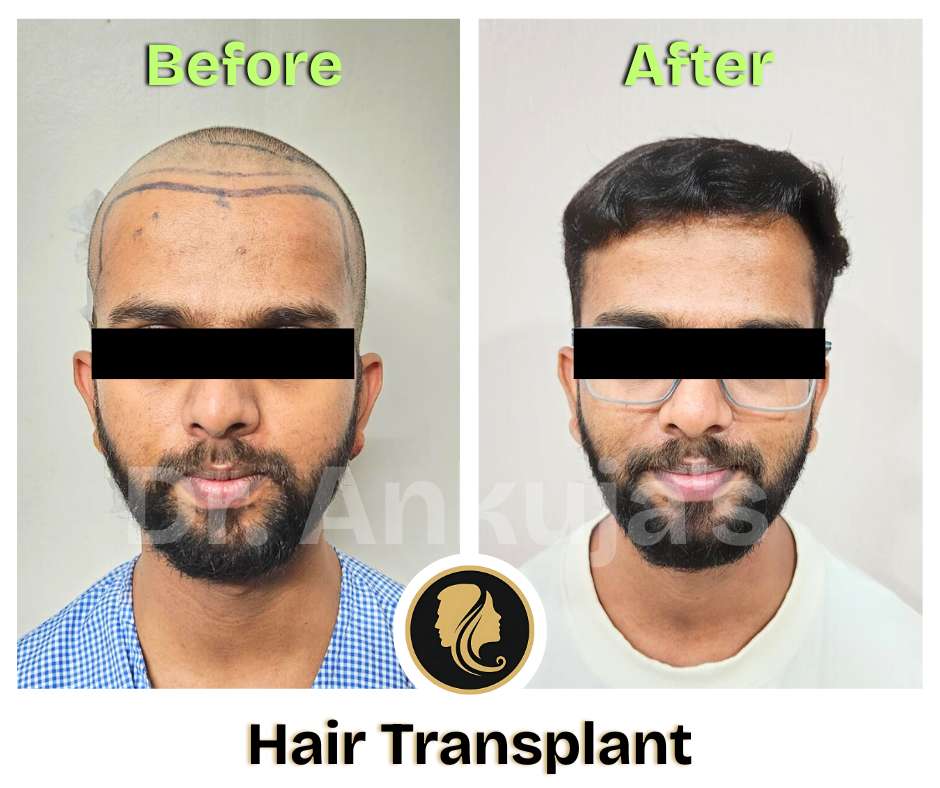 Dr. Ankuja Before After 10