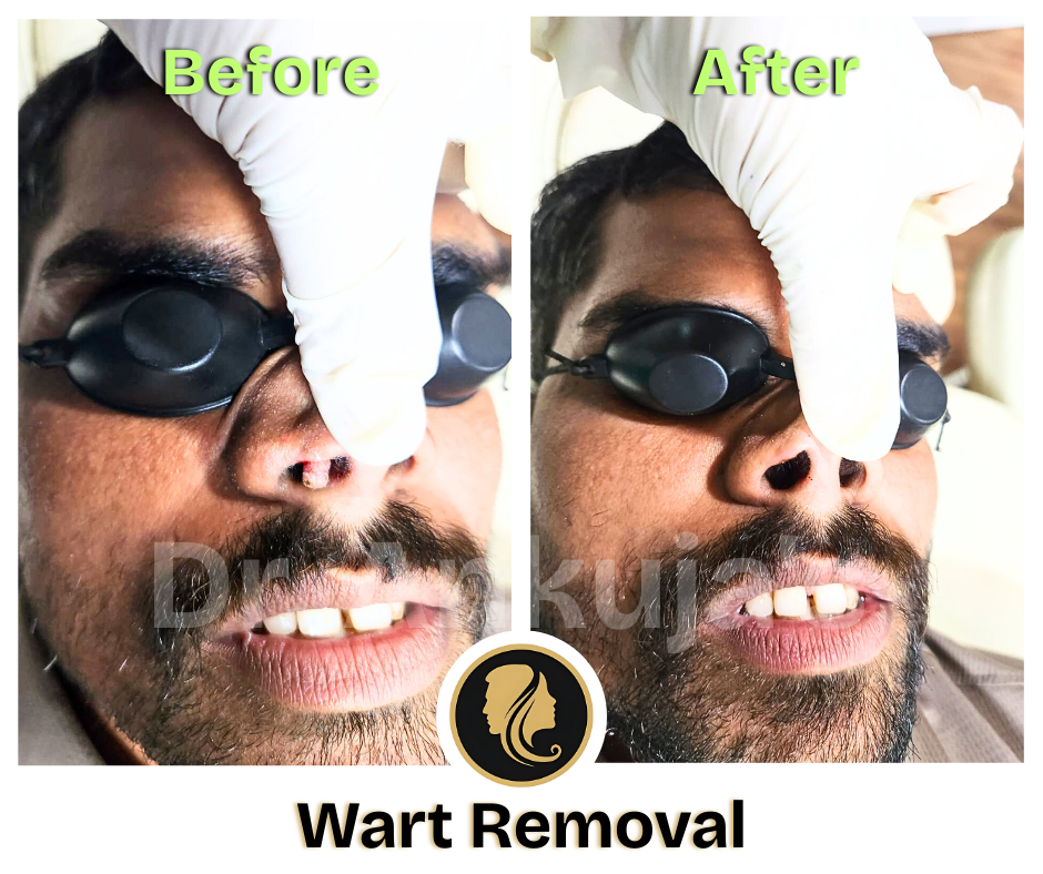 Dr. Ankuja Before After 11