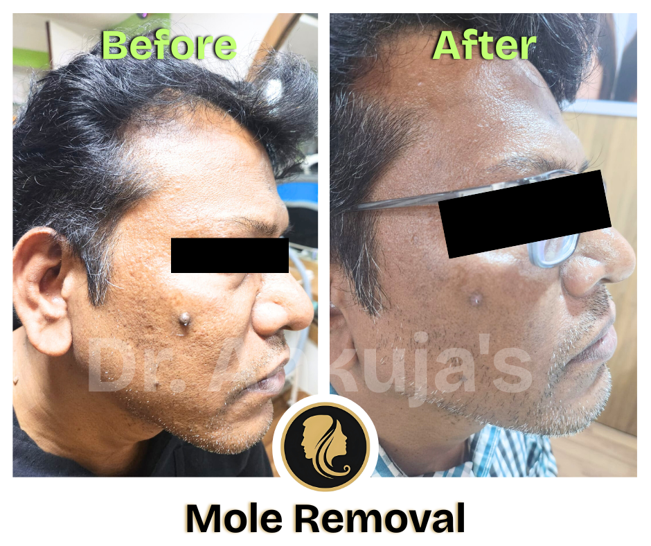 Dr. Ankuja Before After 12