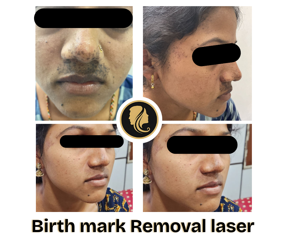 Dr. Ankuja Before After 2