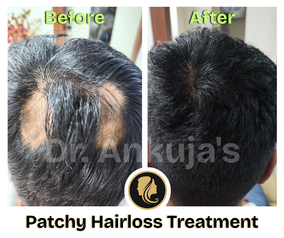 Dr. Ankuja Before After 3
