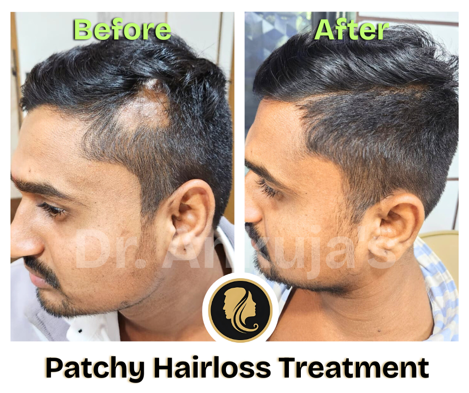 Dr. Ankuja Before After 5