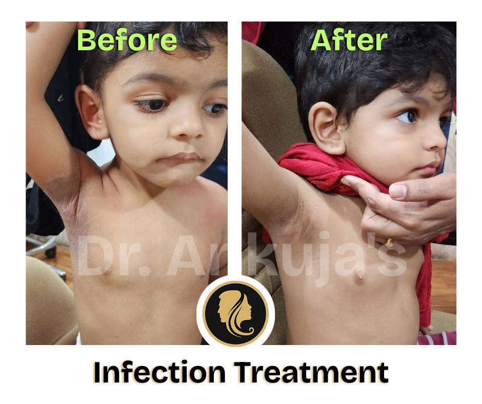 Dr. Ankuja Before After 6