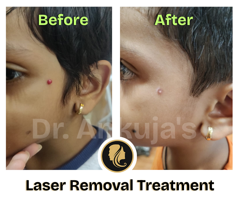 Dr. Ankuja Before After 7
