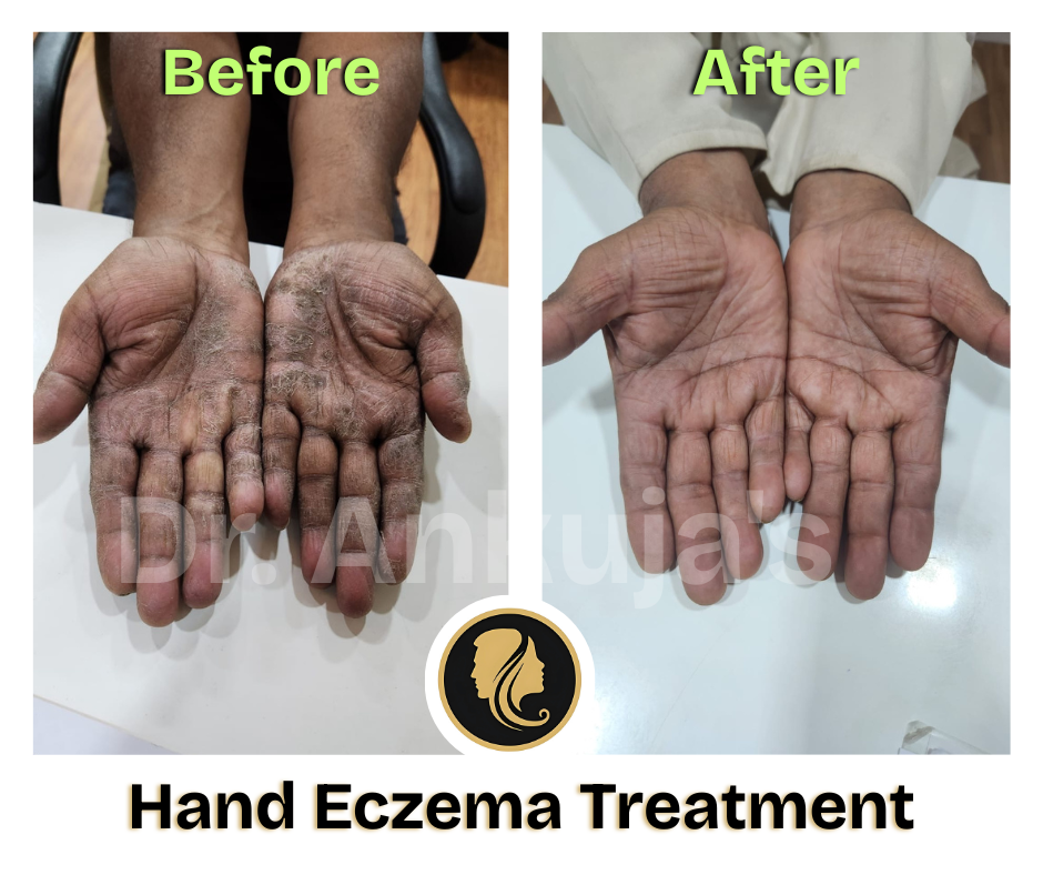 Dr. Ankuja Before After 8