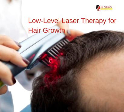 low-level-laser-therapy