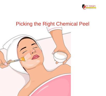 chemical-peel
