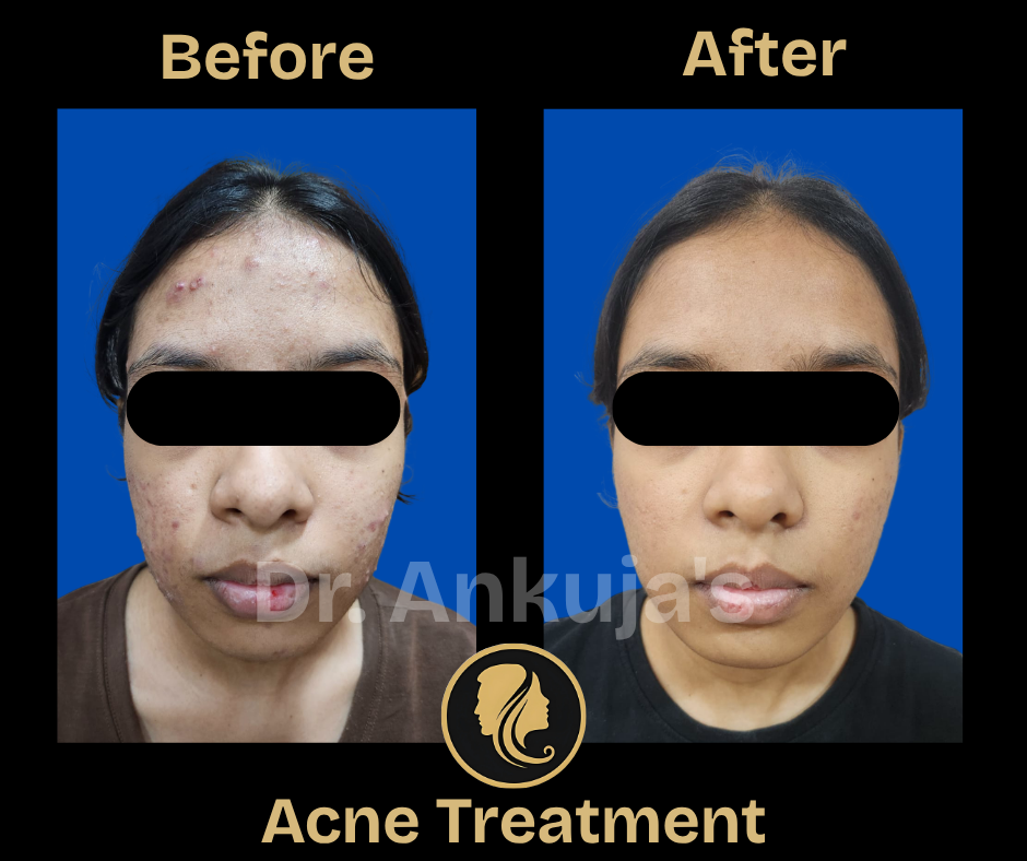 skin-care-before-after