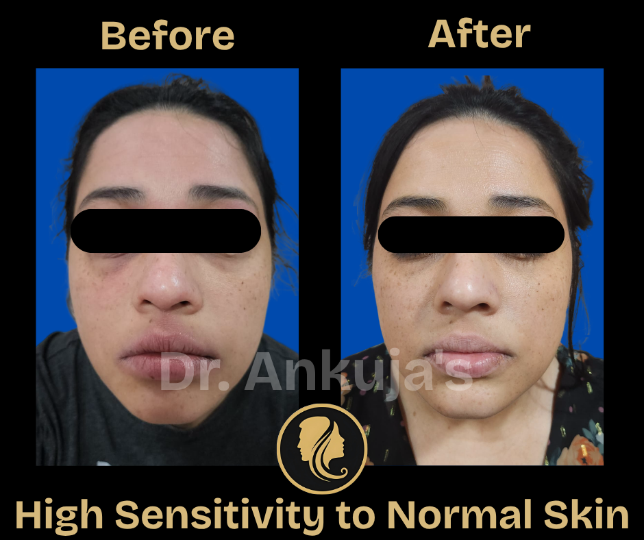 skin-care-before-after