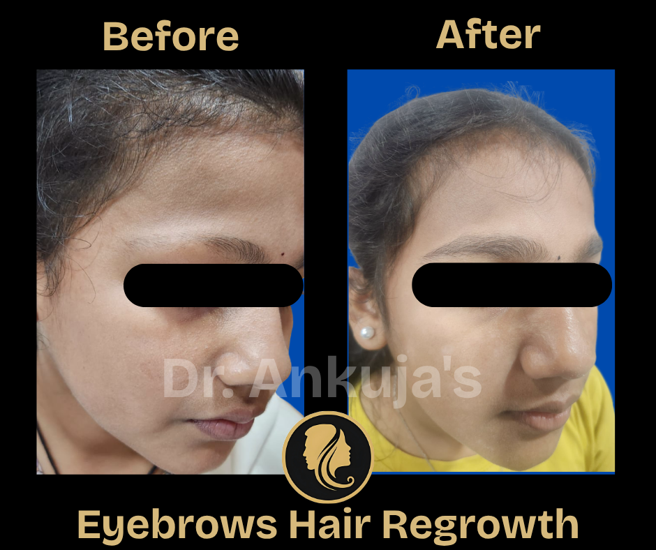 skin-care-before-after