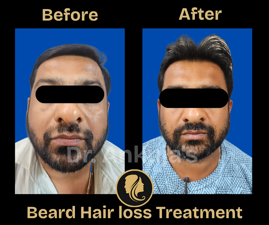 skin-care-before-after