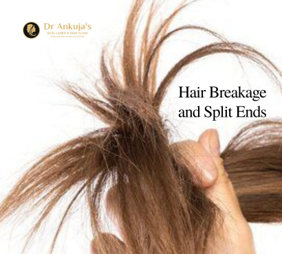 Hair-Breakage-and-Split-Ends