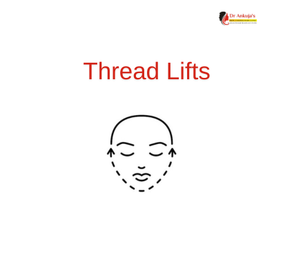 thread-lift