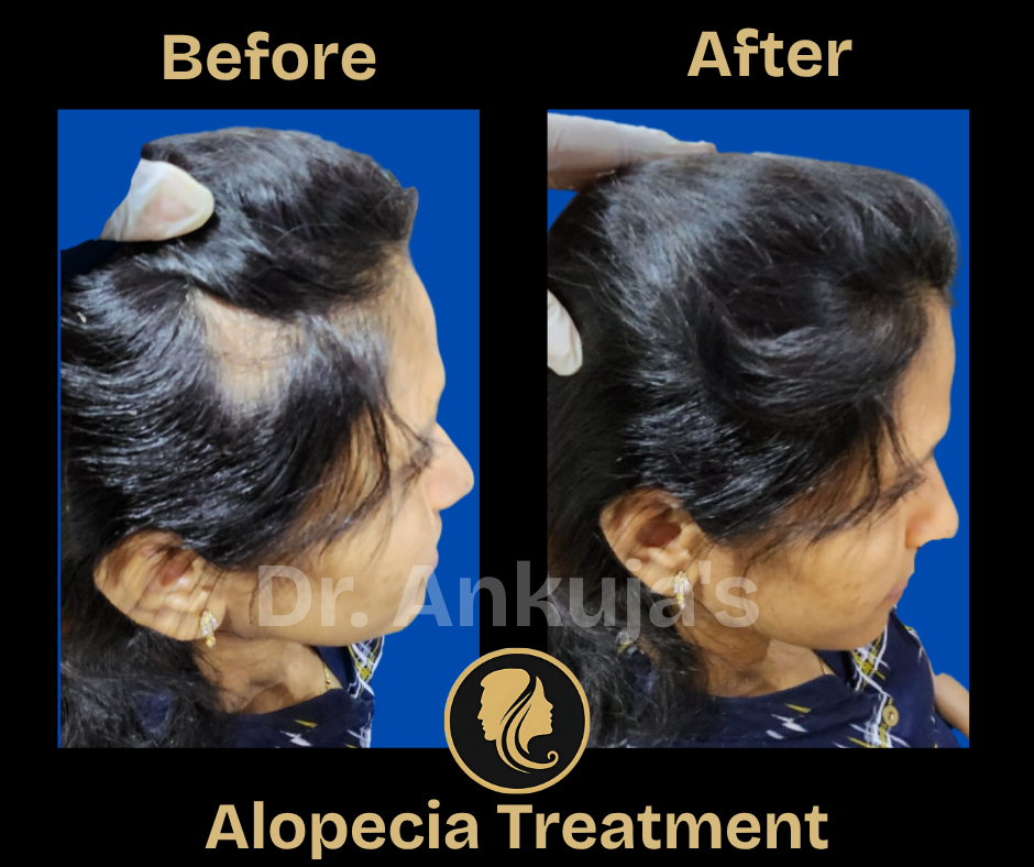 hair-treatment-results