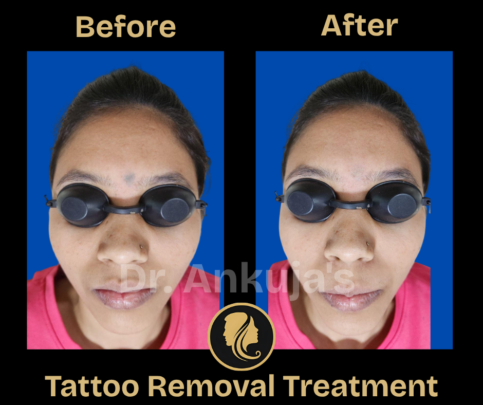 skin-treatment-results