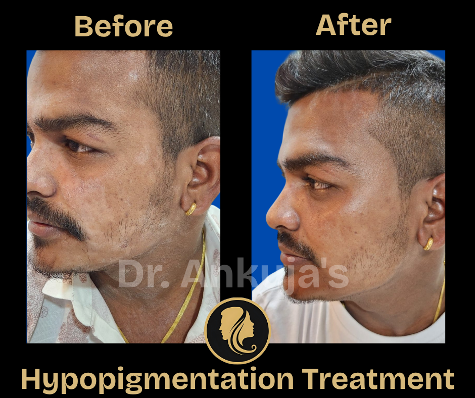 skin-treatment-results