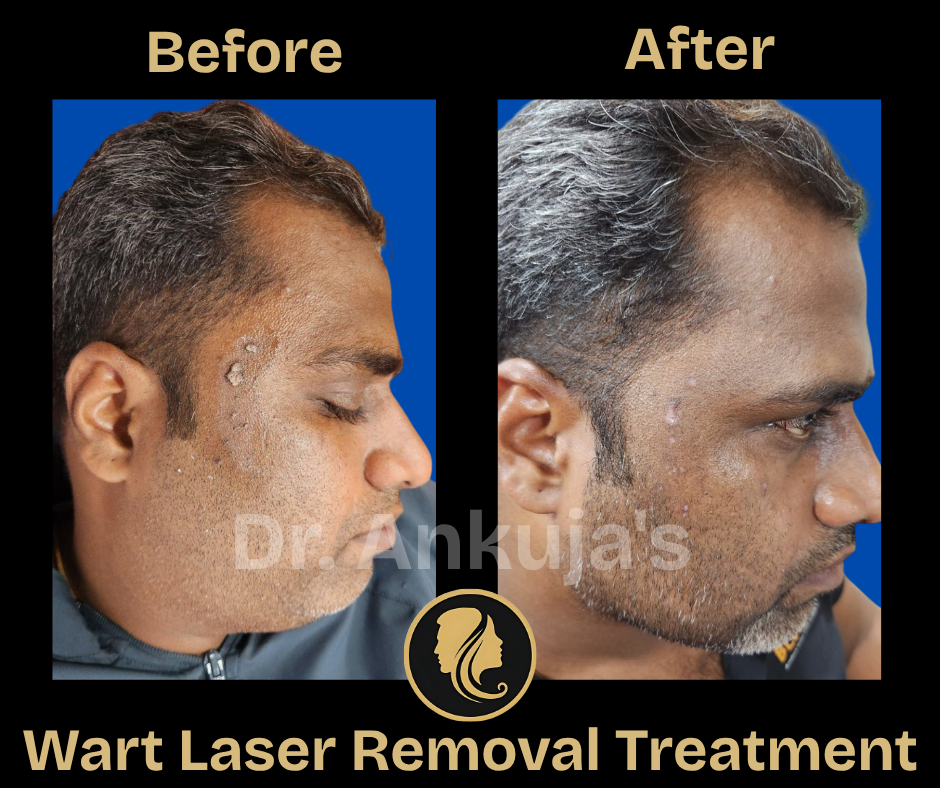 skin treatment results