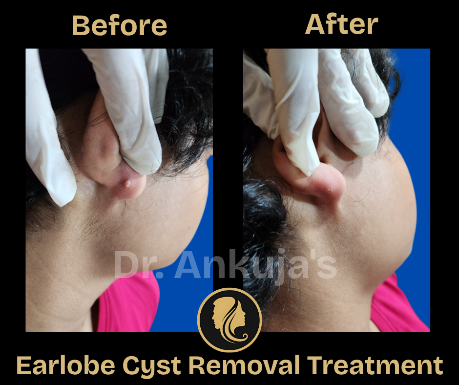 skin treatment results