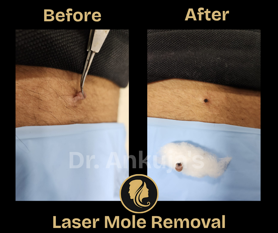 skin-treatment-results