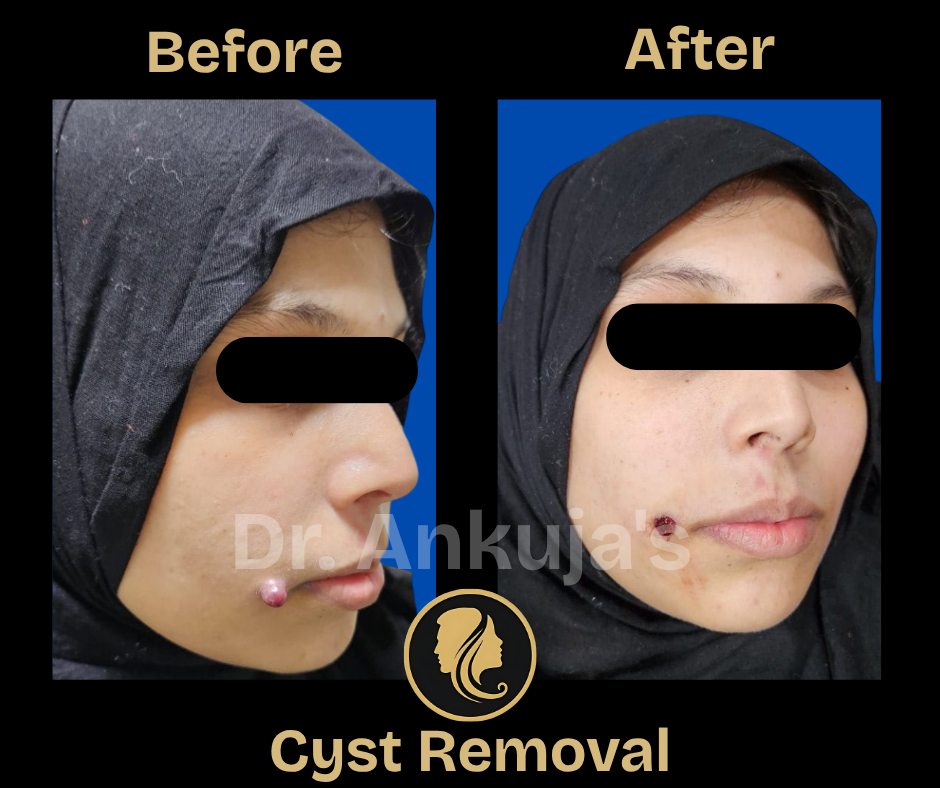 skin treatment results