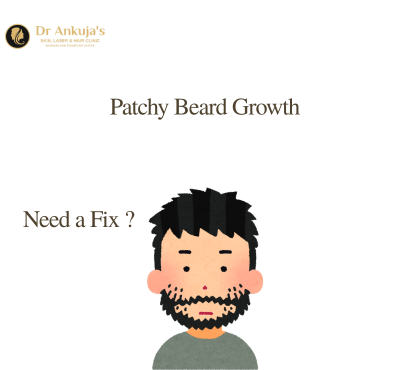 patchy-beard-growth