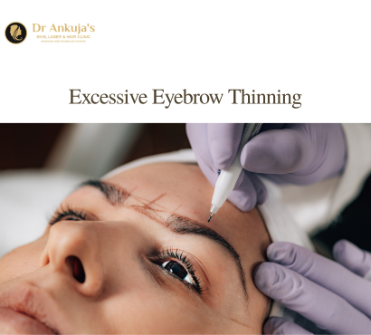 excessive-eyebrow-thinning