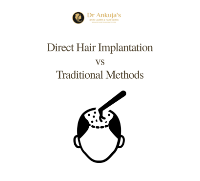 Hair-Implantation