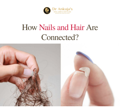Nails-and-Hair-loss